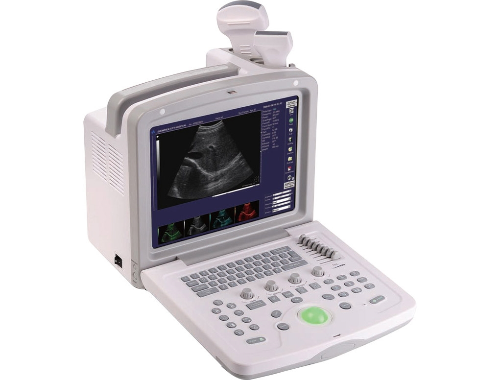 Full Digital Ultrasonic Diagnostic System